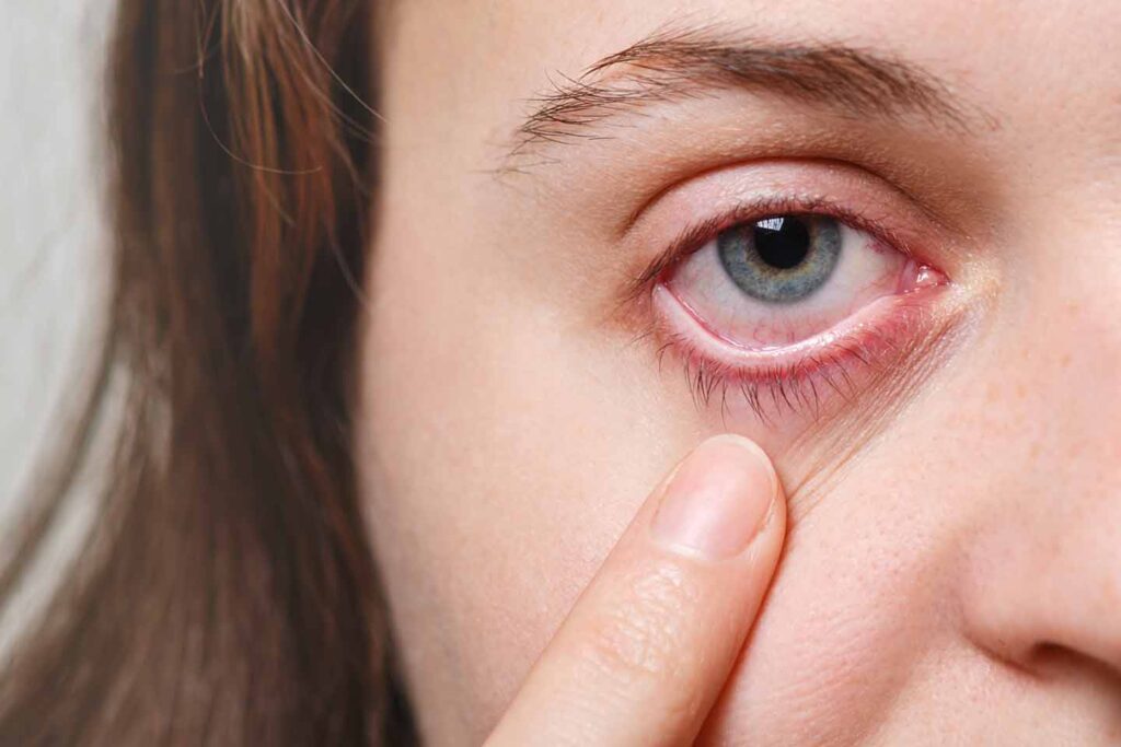 esta es una imagen Enfermedades Oculares: Causas, Síntomas, Tratamientos y Cuidados